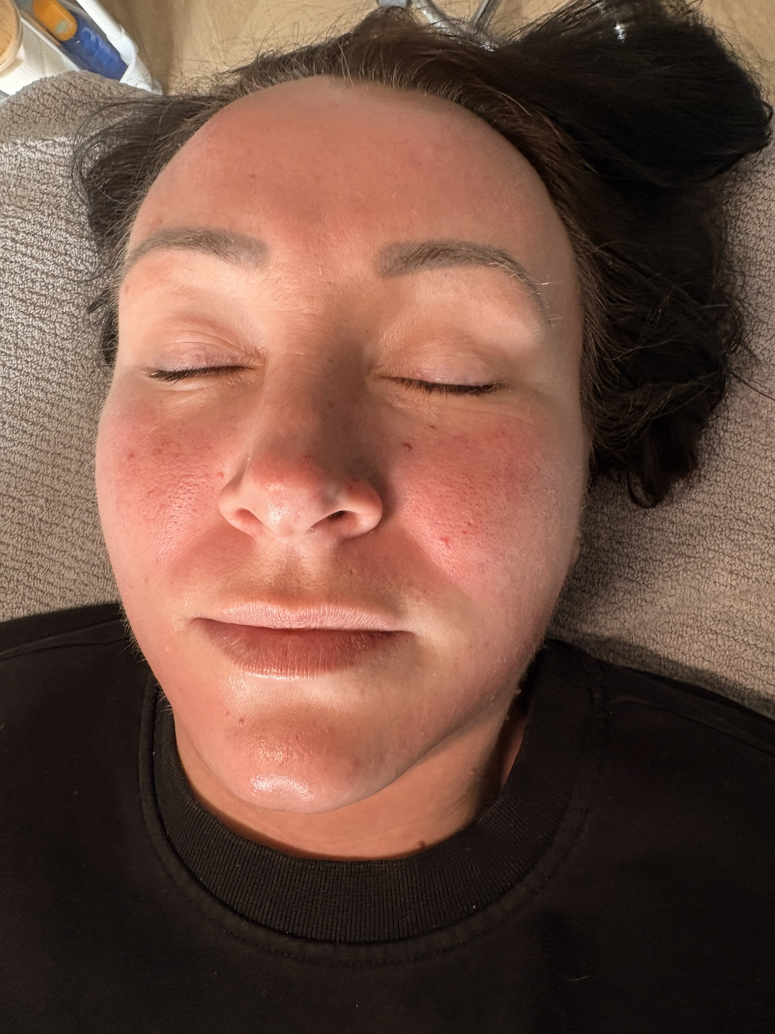 After treatment